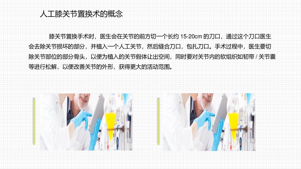 人工膝关节表面置换术护理查房PPT课件8