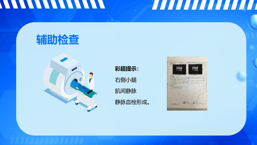 下肢深静脉血栓的护理查房ppt7