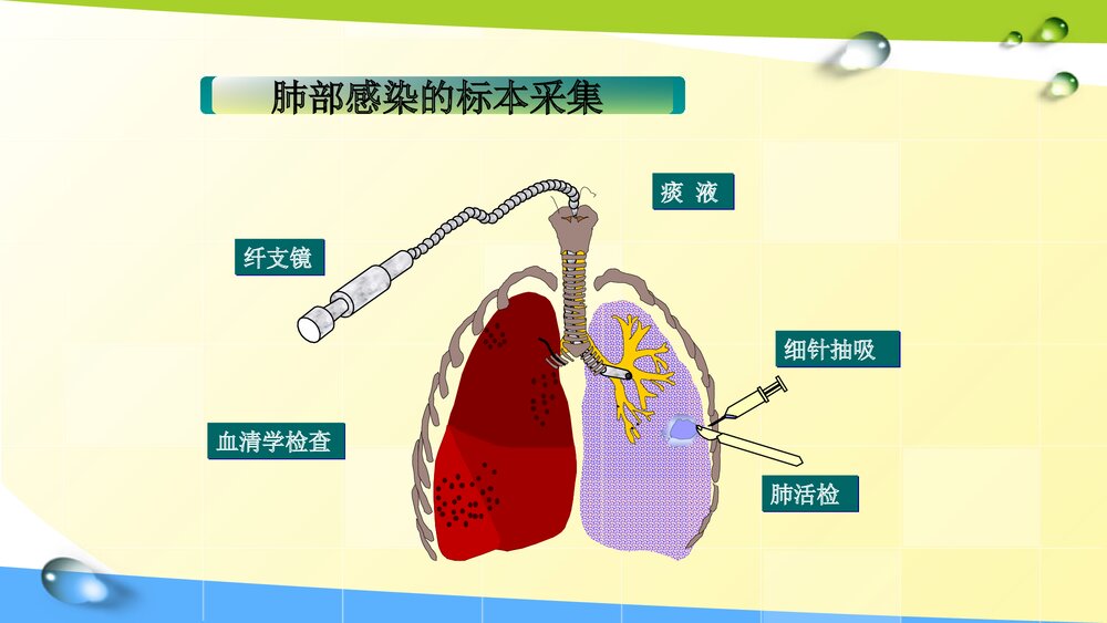 痰标本采集与结果判读讲课PPT课件6
