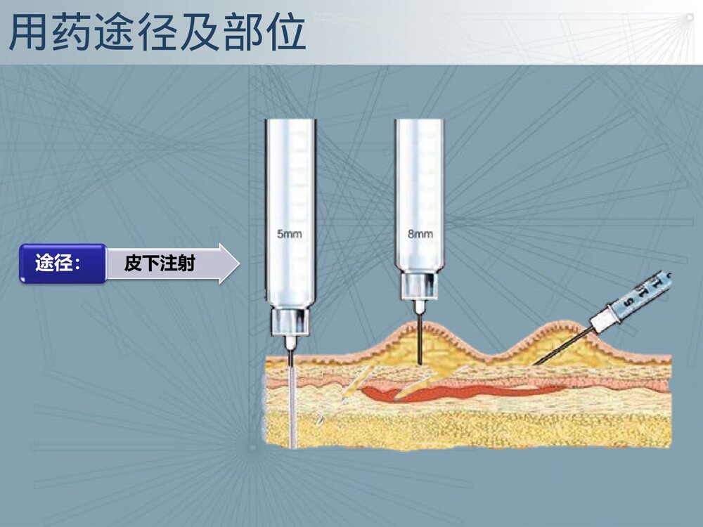 低分子肝素钙皮下注射皮下出血的原因及护理对策PPT课件下载5