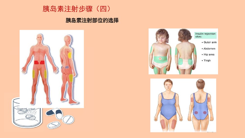 胰岛素注射技术PPT课件下载8