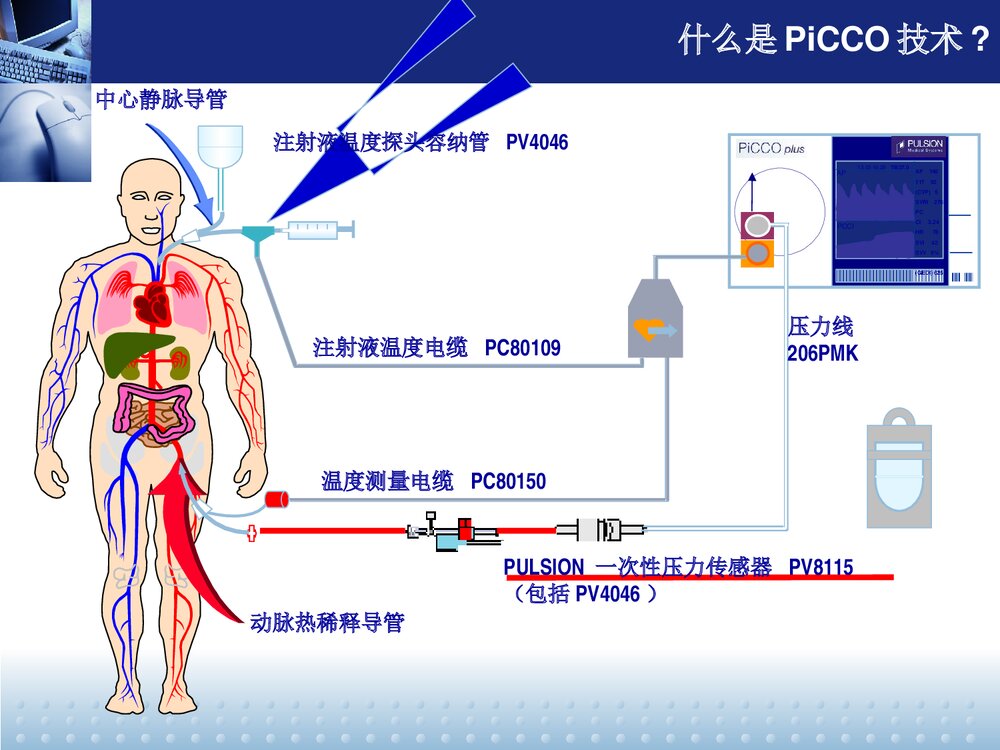 PiCCO监测及护理PPT课件下载4