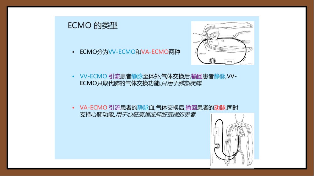 ECMO体外膜肺氧和护理PPT课件下载8