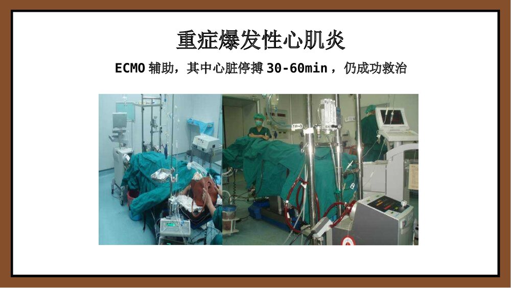 ECMO体外膜肺氧和护理PPT课件下载9