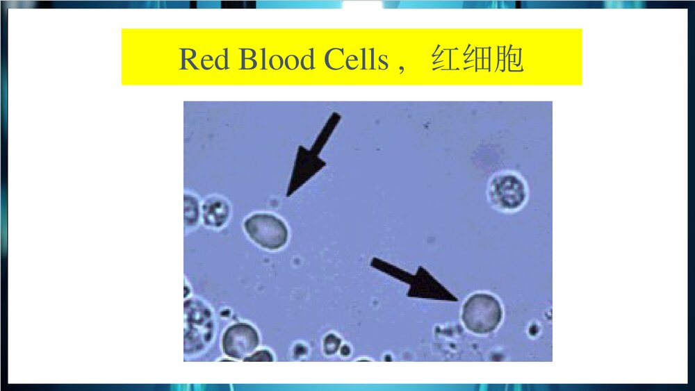 尿常规和沉渣检查PPT课件下载8