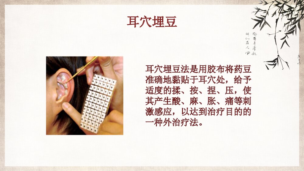 中医护理耳穴压豆PPT课件下载ppt5