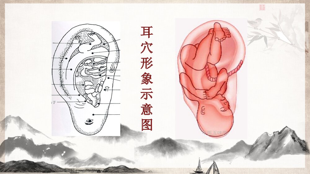 中医护理耳穴压豆PPT课件下载ppt7