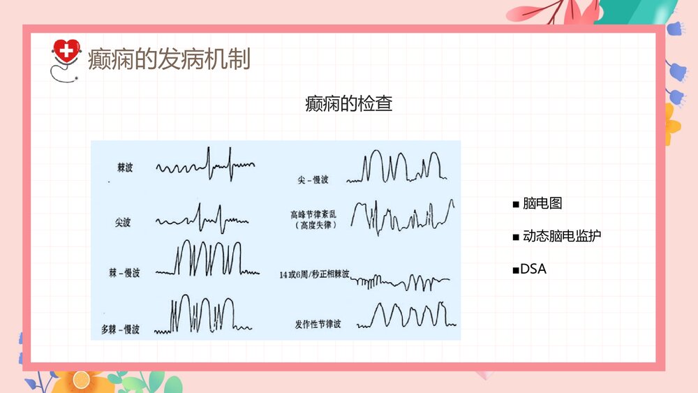 癫痫发作的护理查房PPT课件下载9