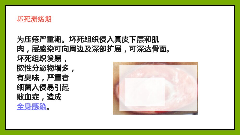 压疮的护理方法PPT课件10