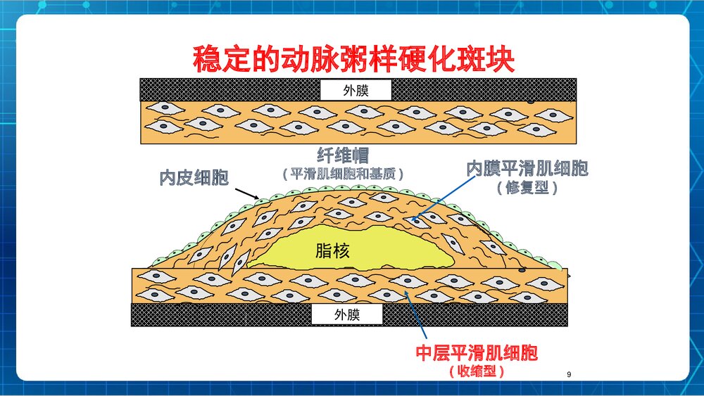 冠心病教学课件PPT下载 ppt9