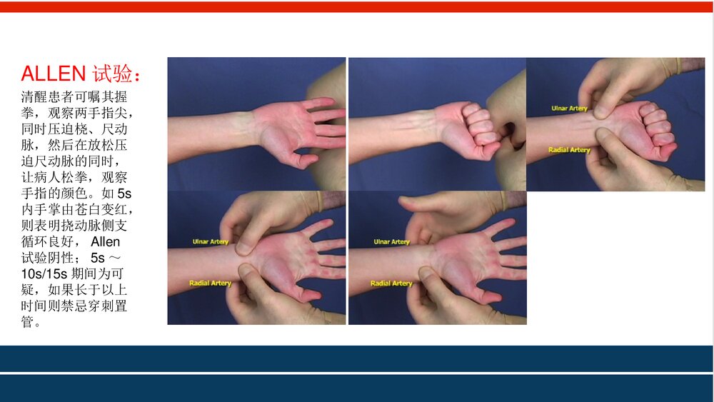 ICU动脉采血血气分析PPT课件下载9